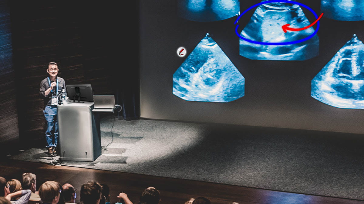 Academic speaker highlighting features on sonogram images using SMART Ink technology in a lecture hall.